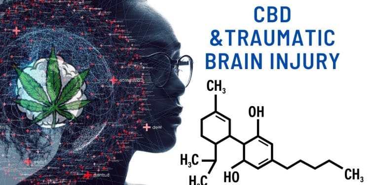 Unveiling CBD’s Healing Power for Brain Injuries